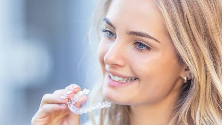 teeth aligners at home - teena